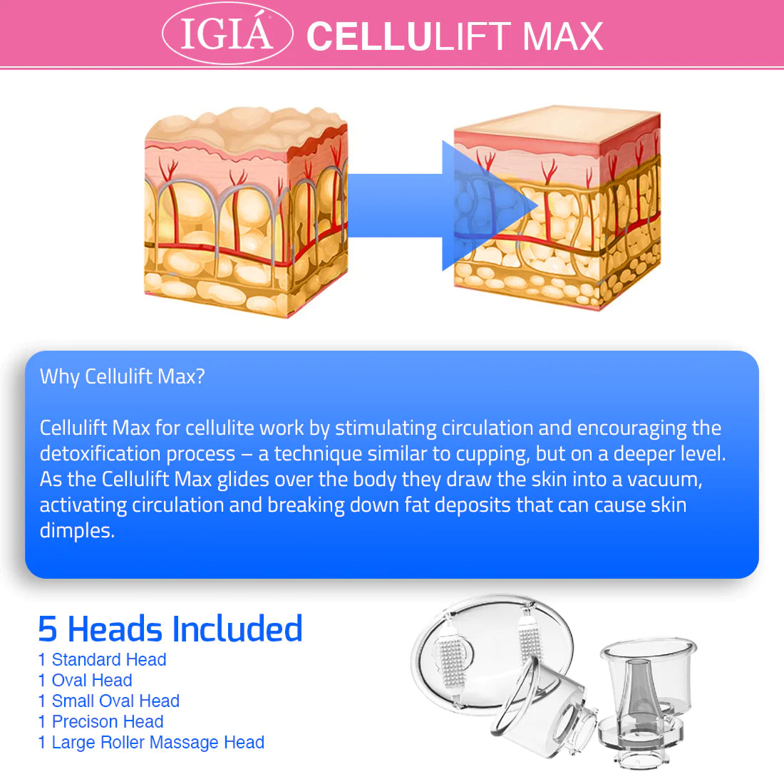 Cellulift Max Cellulite Massager